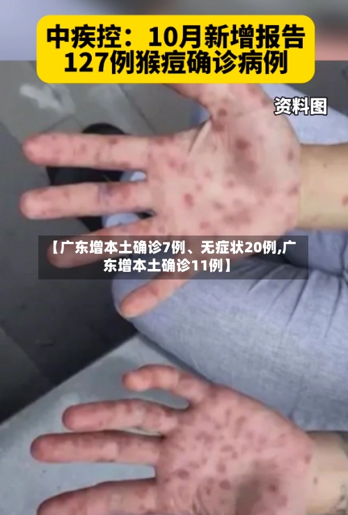 【广东增本土确诊7例	、无症状20例,广东增本土确诊11例】-第3张图片